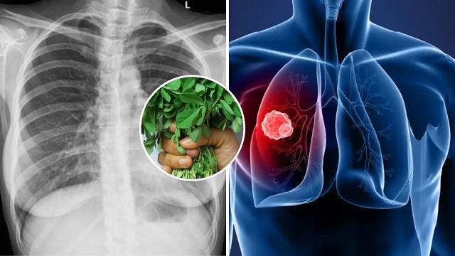 फेफड़े छलनी कर रहा Air Pollution, खाते रहे ये 5 चीजें, Lungs होते रहेंगे Detox