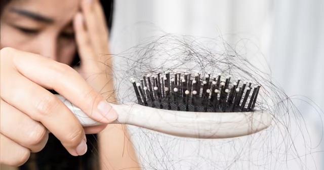 हाथों में आने लगे बालों का गुच्छा यह सिर्फ हेयर फॉल नहीं, इन 6 गंभीर बीमारियों का हो सकता है संकेत