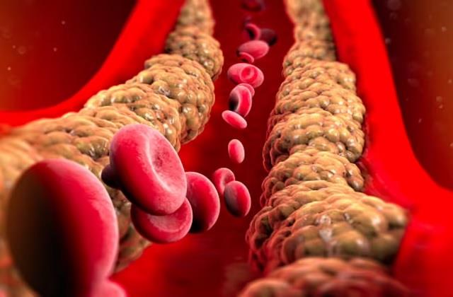 Cholesterol से भर गया है शरीर, यहां आपको संभलने की जरूरत