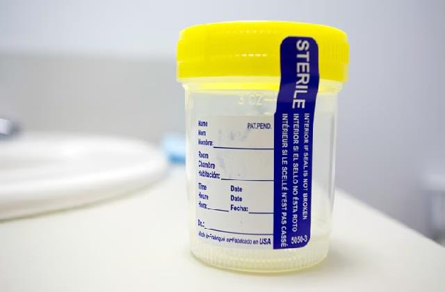 यूरिन में  बार- बार हो रही पस Infection तो इसके कारण और इलाज जानिए