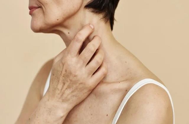 एक ऐसी बीमारी जिसकी शिकार है 70% महिलाएं, आप भी हो जाइए Alert