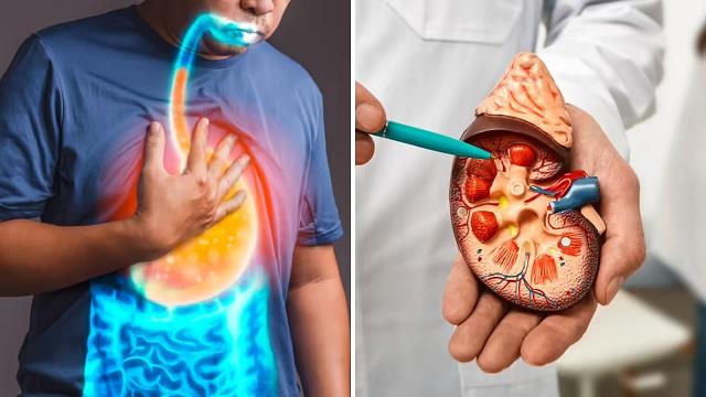 पेनकिलर ही नहीं, एसिडिटी की ये दवाएं भी कर सकती हैं किडनी खराब, डॉक्टर ने दी चेतावनी