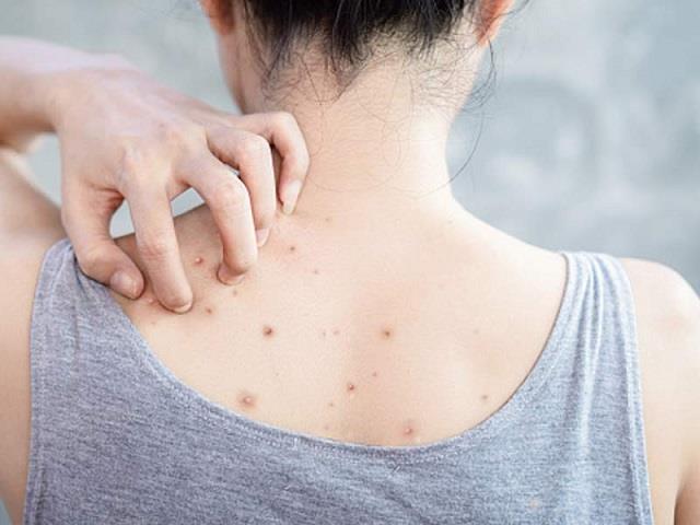 त्वचा पर काले धब्बे दिखें तो नज़रअंदाज़ न करें, जानें कब हो जाएं सतर्क