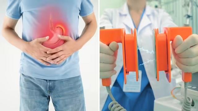 गैस की शिकायत लेकर पहुंचा मरीज, सोचा नहीं था ये कारण होगा,देने पड़े 23 बिजली के झटके