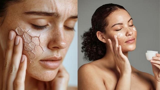 सर्दियों की ठंड ने कर दिया चेहरा रूखा? ये 5 नेचुरल पैक्स देंगे मुलायम और ग्लोइंग स्किन