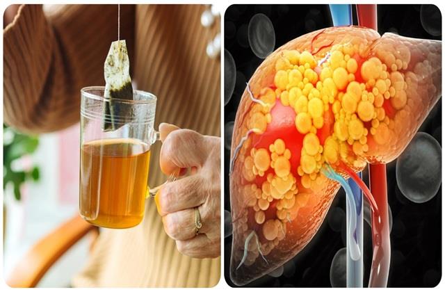 Liver के लिए जहर है आपकी ये पसंदीदा चाय, चुपचाप कर देगी सब बर्बाद!