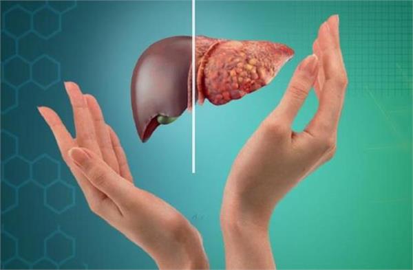 ये लक्षण बता रहे कि Liver में बहुत Fat जमा है...देसी काम शुरू कर दें !