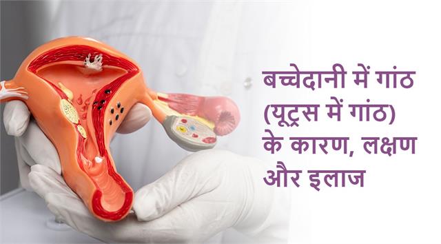 बच्चेदानी में रसौली होने के हैं ये सारे संकेत, लापरवाही बरती तो हो जाएगी मुश्किल