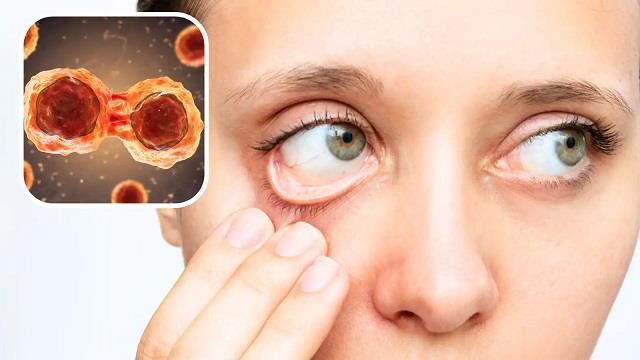 खून की कमी के 5 खतरनाक संकेत, इन्हें हल्के में लेना पड़ सकता है भारी