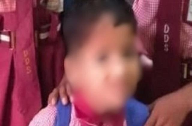 नर्सरी के बच्चे के लिए यमराज बनी टीचर, थप्पड़ मार-मारकर कर दी मासूम की हत्या