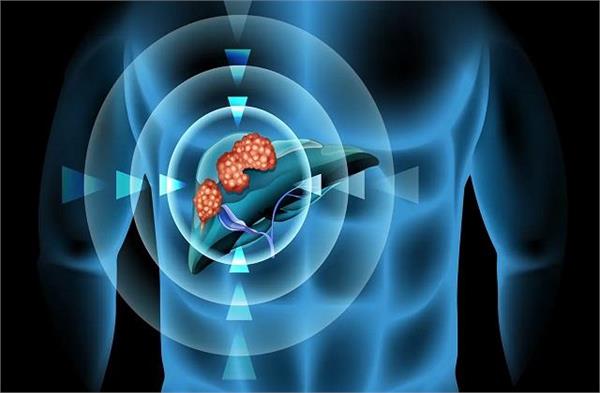 हर Liver ट्यूमर से नहीं होता कैंसर, पहले शरीर के इशारे को समझो फिर डॉक्टर से मिलो