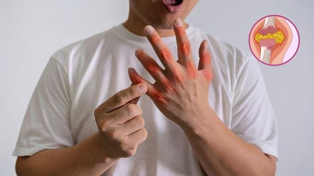 Uric Acid के मरीज करें ये एक्सरसाइज, मिलेगा जबरदस्त फायदा