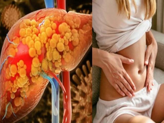 बिना टेस्ट के घर बैठे पहचानें आपका Liver कितना है Healthy