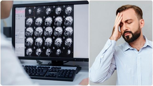 World Brain Tumor Day 2025: सिरदर्द को न करें अनदेखा, ये लक्षण बढ़ाते हैं ब्रेन ट्यूमर का खतरा