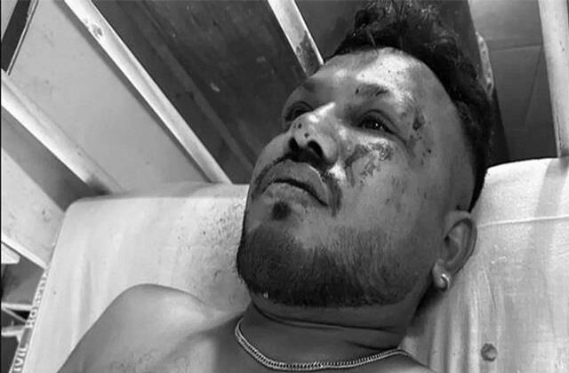 आग का गोला बन गया था प्लेन, चारों तरफ बिखरी थी लाशें ... मौत को मात देकर हादसे में जिंदा बच गया ये शख्स