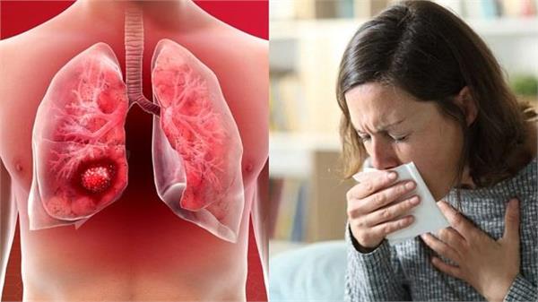 मामूली लगने वाले छोटे-छोटे लक्षण देते हैं  Lung Cancer का संकेत, समय रहते करवा लें टेस्ट