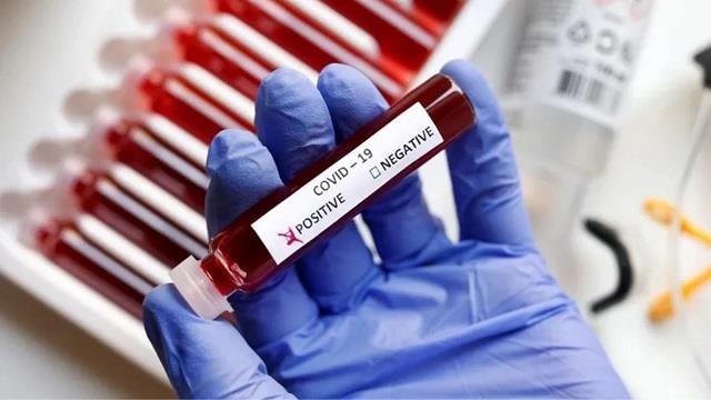 सर्दी-खांसी होते ही Corona Test के लिए न भागें, कोविड ऑफिसर की लोगों को राय