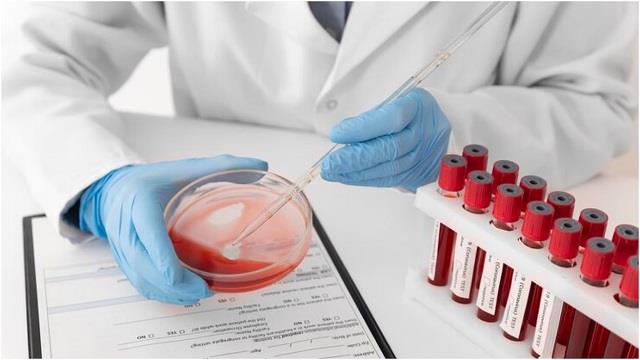 30 की उम्र के बाद जरूर करवाएं ये 5 Blood Test, थायराइड से लेकर कैंसर तक का चलेगा पता