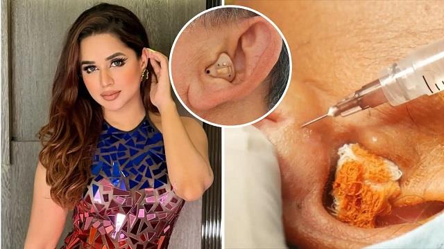 8 घंटे तक AirPods लगाए सुना म्यूजिक, लैंडिंग के बाद लड़की हुई बहरी
