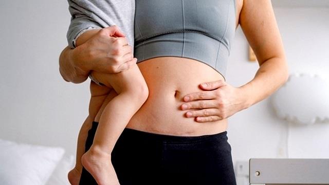 C-Section के बाद टांके और दर्द से परेशान हैं? अपनाएं ये 5 आसान उपाय, जल्द मिलेगी राहत
