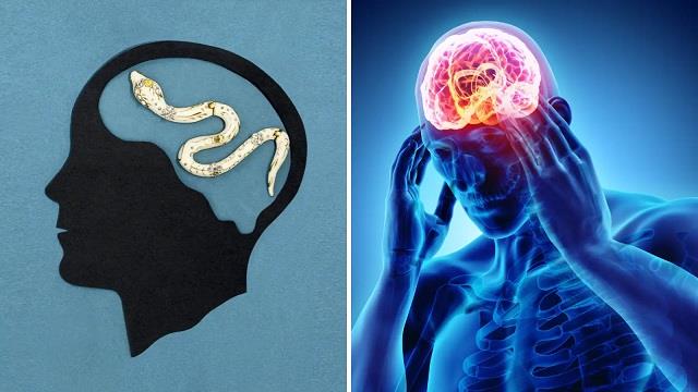 मानसून में दिमाग पर अटैक कर सकता है यह कीड़ा,लगातार रहते हैं 2 लक्षण तो तुरंत भागें डॉक्टर पास