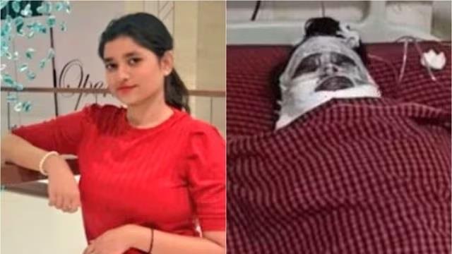 बेस्ट फ्रैंड की खूबसूरती और फोन से ऐसी जलन कि तेजाब से कर दिया चेहरा खराब