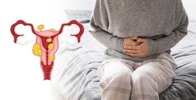 आपके मां बनने का सपना छीन सकती है गर्भाशय की गांठ, इन लक्षणों को न करें नजरअंदाज