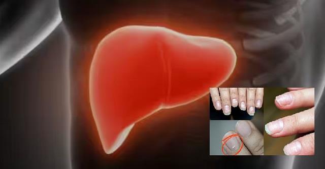 उंगलियों और नाखूनों में दिखते हैं लिवर डैमेज के संकेत, समय रहते पहचानें ये लक्षण