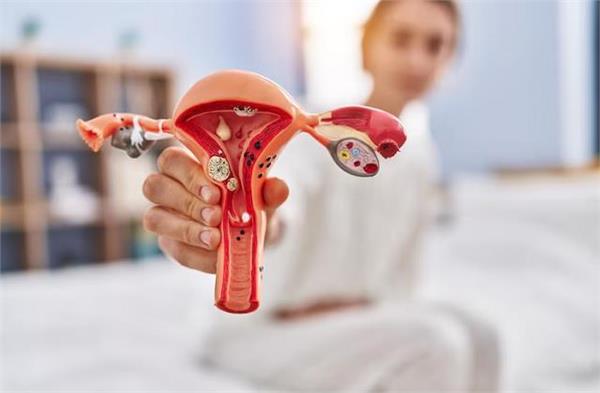 पानी और खून वाली रसौली में फर्क समझें, यूट्रस को किससे ज्यादा खतरा?