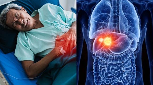 Liver पर अटैक करने वाला खतरनाक Virus, बना Liver Cancer की बड़ी वजह WHO रिपोर्ट में खुलासा
