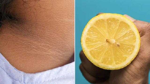 गर्मियों में गर्दन की काली त्वचा और टैन से परेशान? अपनाएं ये आसान घरेलू टिप्स, पाएं दमकती और साफ़ स्किन