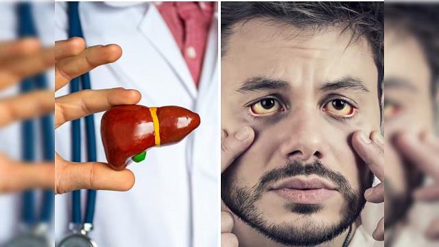 आंखों में दिखता है लिवर गलने का पहला लक्षण, समय रहते खाना शुरू करें ये एक चीज