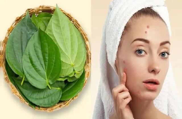 पान के पत्ते से दूर करें चेहरे के जिद्दी Pimples, झड़ते बालों के लिए भी वरदान