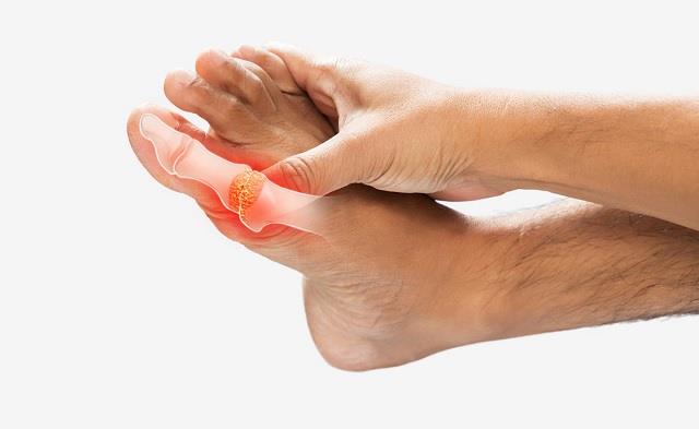 यूरिक एसिड को जड़ से खत्म कर देंगी ये 5 आयुर्वेदिक चीजें, एक्सपर्ट ने शेयर किए नुस्खे