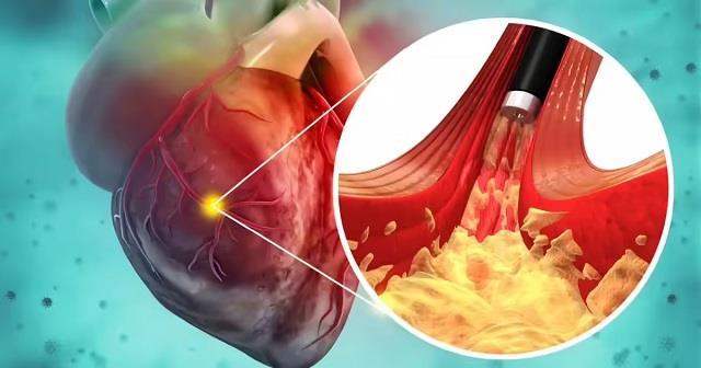 Heart Disease Symptoms: शरीर में दिखें ये लक्षण तो समझें जाएं हार्ट होने वाला है फेल