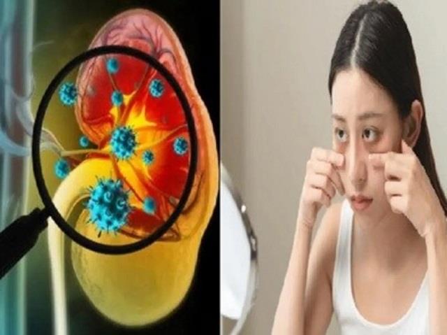 आंखों में दिखें ये 5 बदलाव तो हो जाएं सतर्क, किडनी डैमेज का हो सकता है संकेत