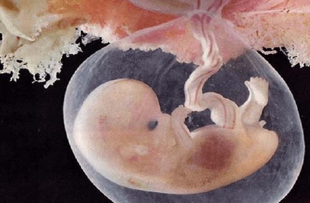 पेट में ही  5 महीने का बच्चे ने तोड़ दिया दम, मां ने हिम्मत दिखाकर अजन्मे को ही कर दिया दान