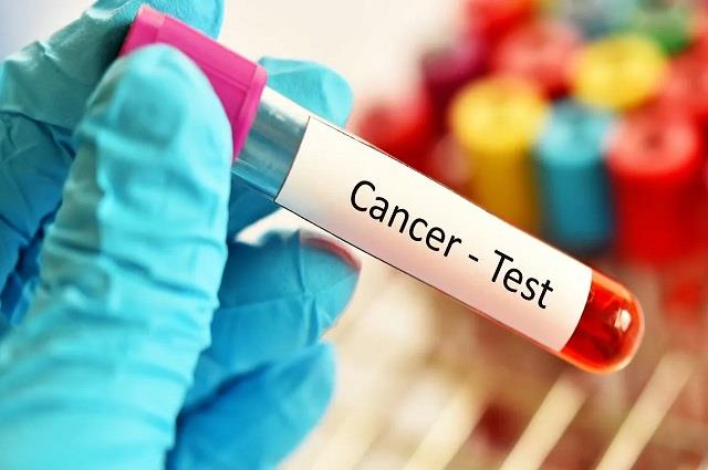 ब्लड टेस्ट से 10 साल पहले ही पकड़ा जा सकेगा कैंसर, वैज्ञानिकों ने बनाई नई तकनीक