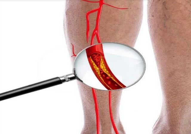 कमजोर नसों में जान फूंक देता है इस मसाले का पानी, ये लोग ज़रूर करें डाइट में शामिल