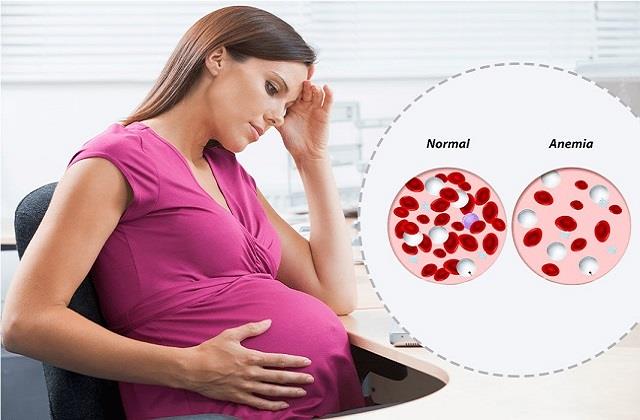 Pregnancy में 1 गलती से श‍िशु में हो सकती है खून की कमी, एक्सपर्ट की चेतावनी