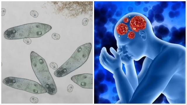 क्या स्विमिंग से शरीर में घुसता है दिमाग खाने वाला अमीबा? जानिए इसके लक्षण और बचाव