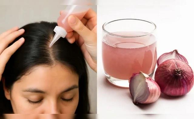 नए बाल उगाने में मददगार प्याज का रस, घर पर अपनाएं ये तीन बेहतरीन उपाय