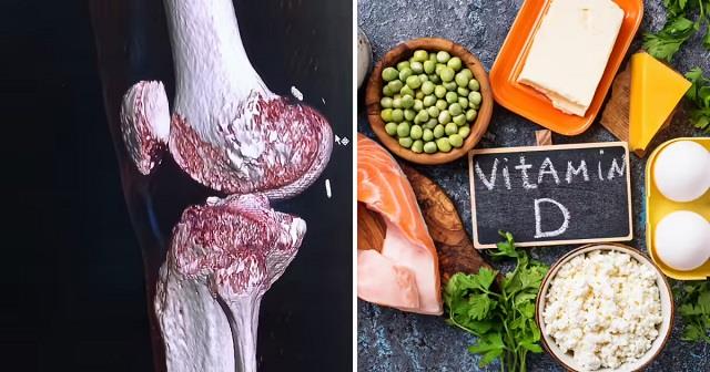 बॉडी में Vitamin D कम होने की ये निशानियां दिखे तो इग्नोर करने की गलती न करें