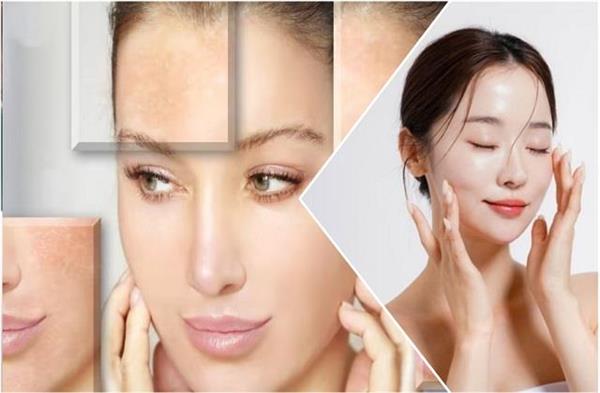 कोरियन ग्लास के चक्कर में स्किन की कई बीमारी ले रही लड़कियां, डॉक्टरों ने दी चेतावनी !