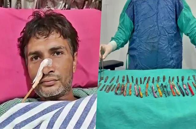 मरीज के पेट से निकले 29 चम्मच, 19 टूथब्रश और दो पेन, गुस्से में खाता था ये चीजें