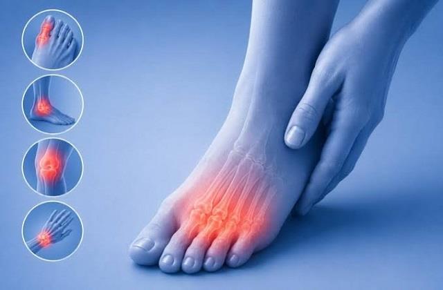 सिर्फ पैर के अंगूठे में नहीं, इन जोड़ों को भी निशाना बना सकता है Uric Acid