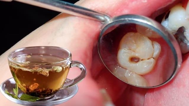 कैविटी से हैं परेशान? दांतों की देखभाल में मदद करती है ये हर्बल Tea