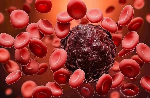 Blood Cancer का खतरा बढ़ा सकती हैं ये आदतें, जानें लक्षण