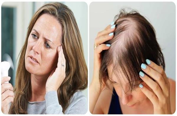 Menopause के दौरान क्यों झड़ने लगते हैं महिलाओं के बाल ?  जानिए कैसे मिलेगा इससे छुटकारा