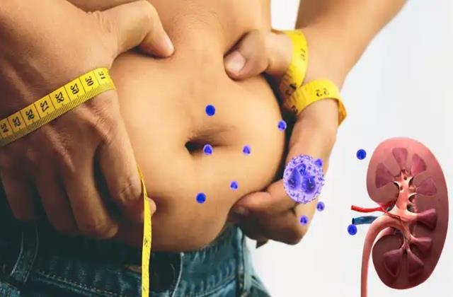 Kidney की बीमारी के कारण भी मोटे होते हैं लोग, अचानक से पेट फूले तो करवा लो जांच